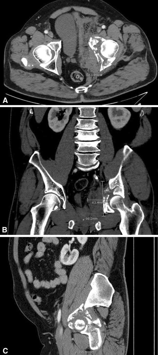 Fig. 1A–C