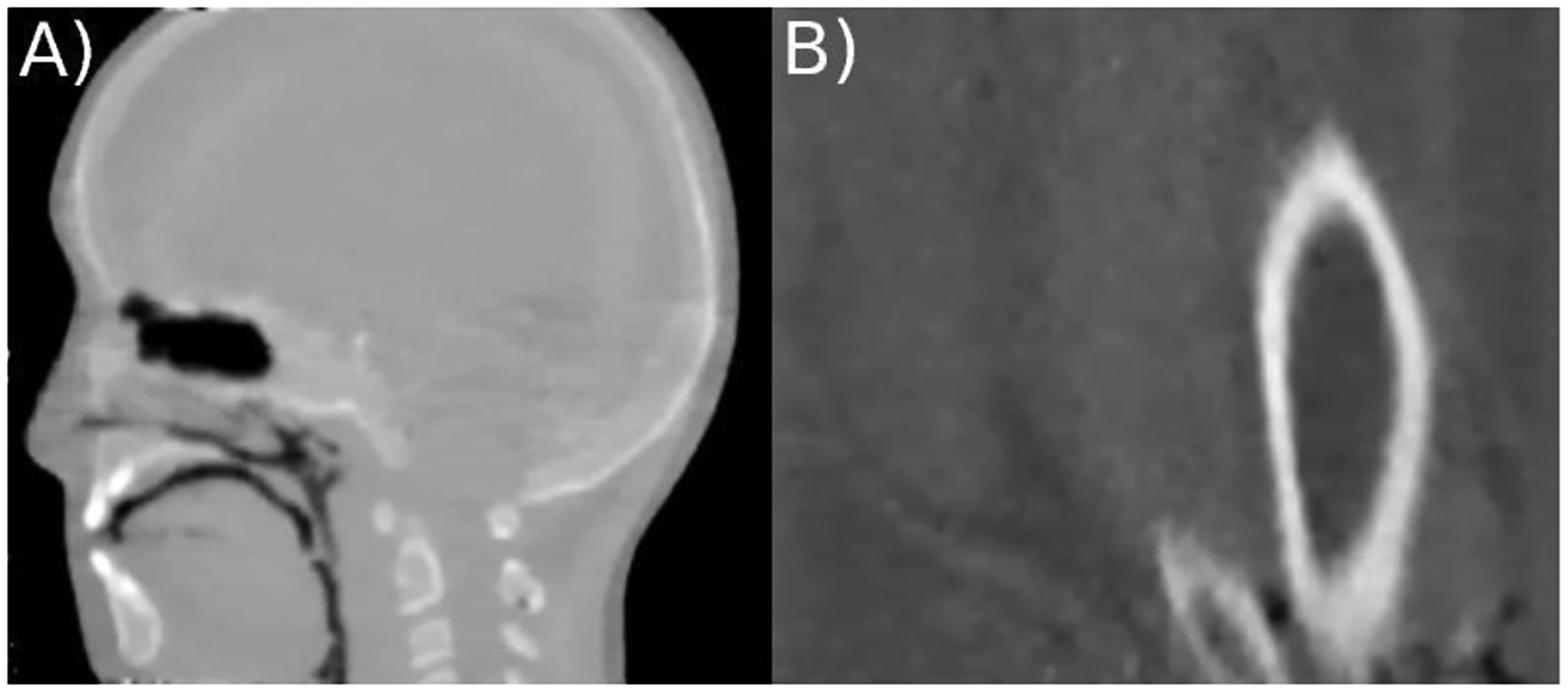 Figure 3: