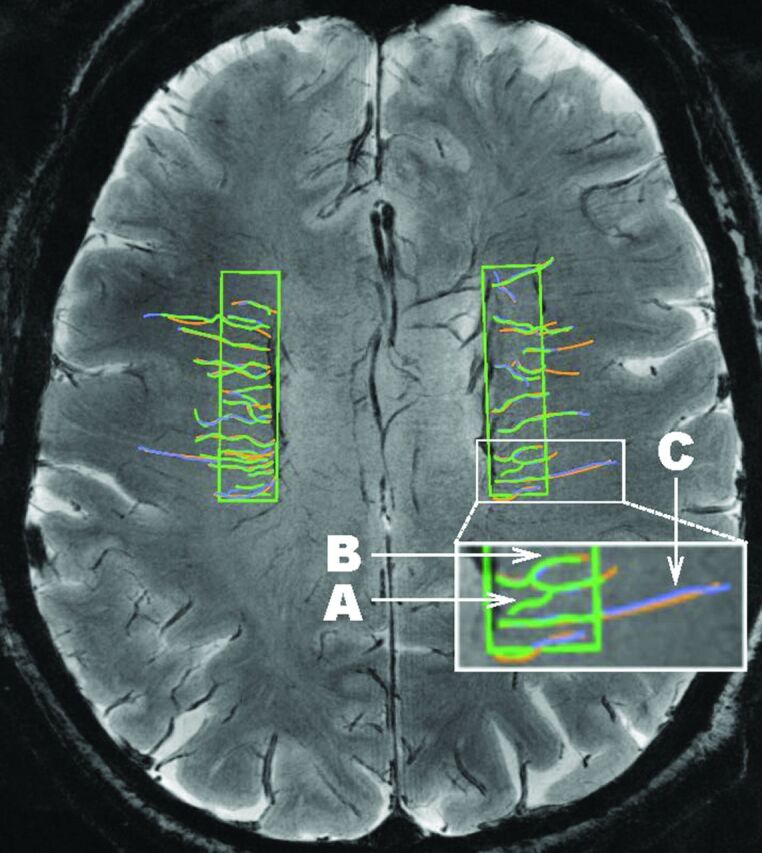 Fig 1.