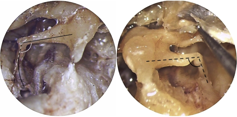 Fig. 2