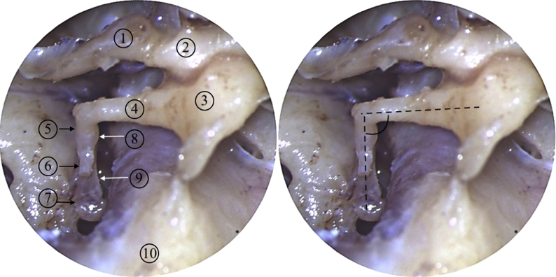 Fig. 1