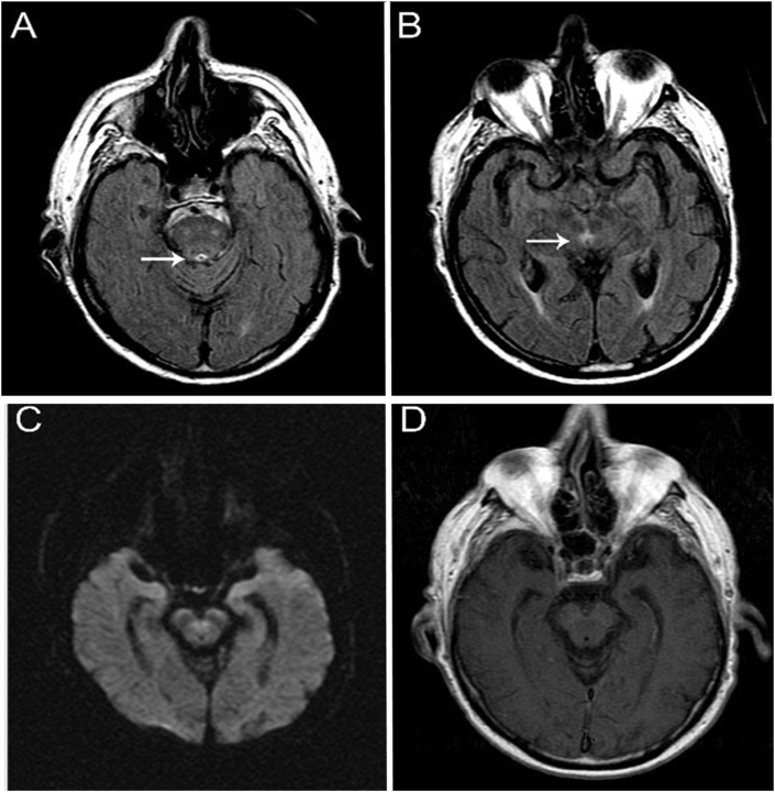 Fig. 1