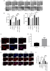 Figure 10. Role of DHCR24–HRAS interaction in bladder carcinogenesis. (A) 5637 cells were stimulated with several drugs, and cell proliferation was observed after 72 h using light microscopy and cell ...
