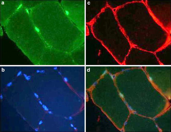 Fig. 1