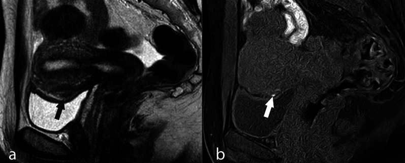 Fig. 14