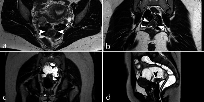 Fig. 9