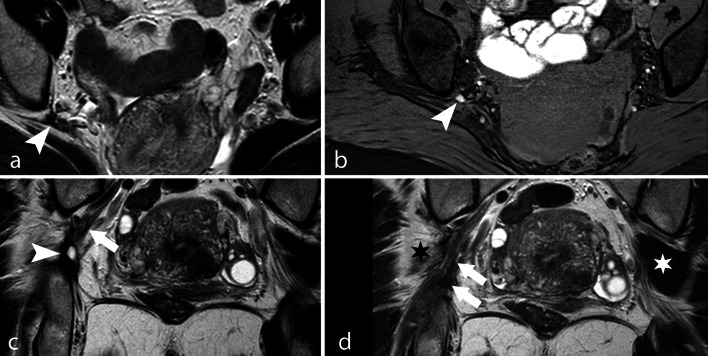 Fig. 15