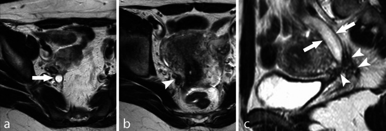 Fig. 11