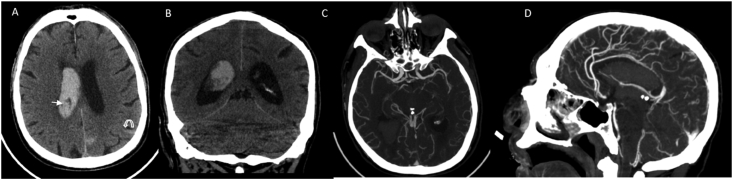 Fig. 4