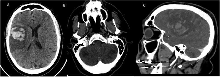 Fig. 5