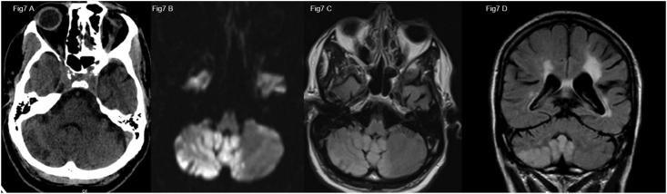 Fig. 7