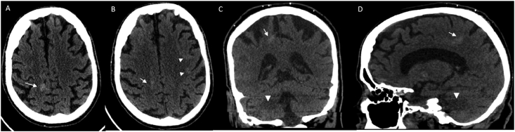 Fig. 6