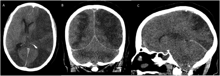 Fig. 1