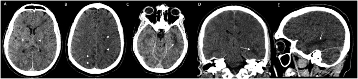 Fig. 2