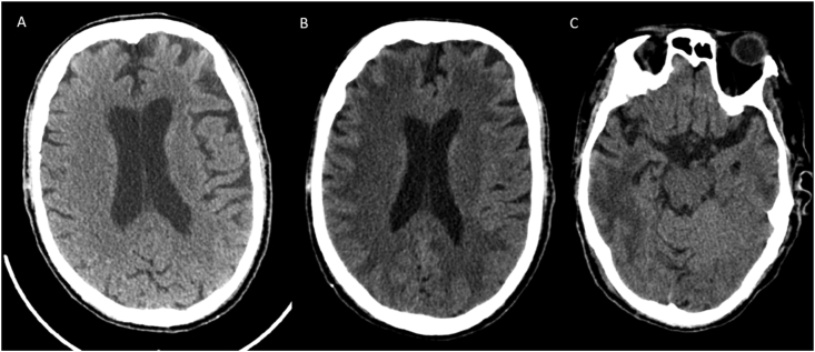 Fig. 3