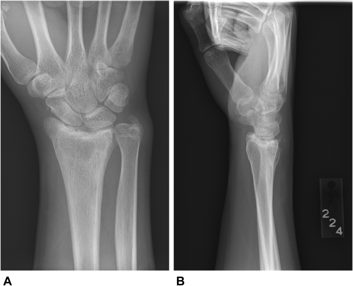 Figure 2