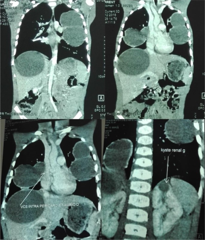 Fig. 2:
