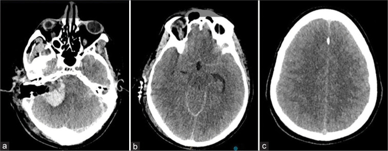 Figure 2: