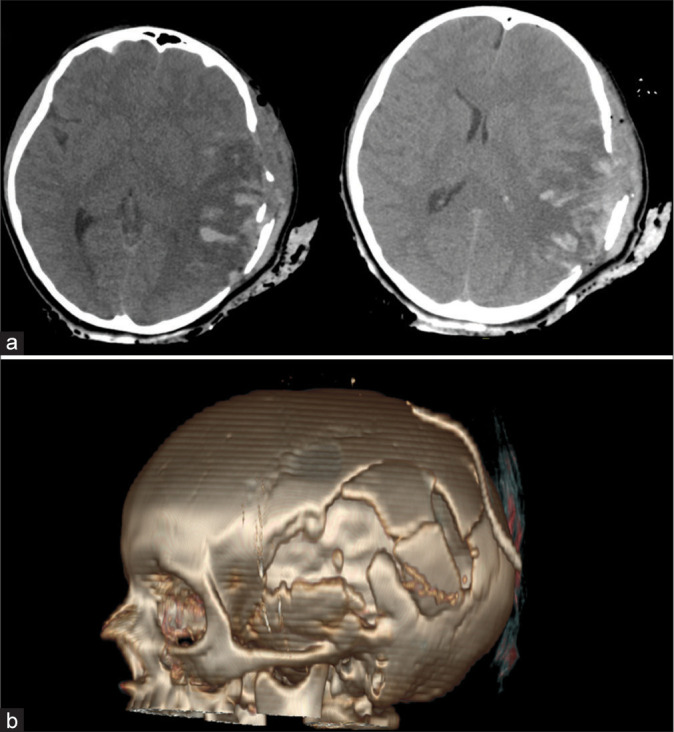 Figure 3: