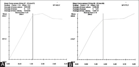 Figure 3 (A and B)