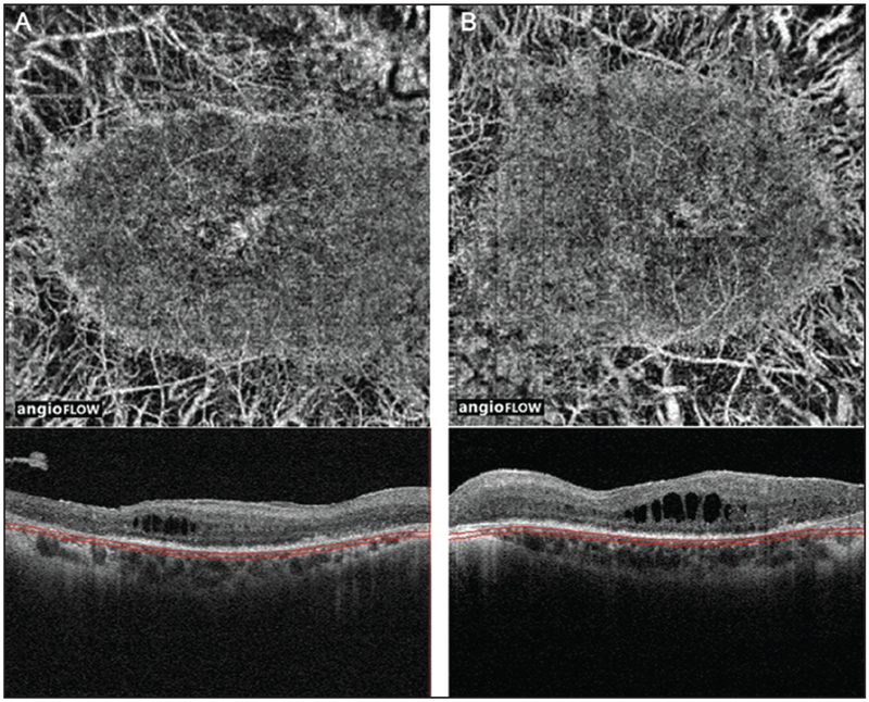 Figure 4: