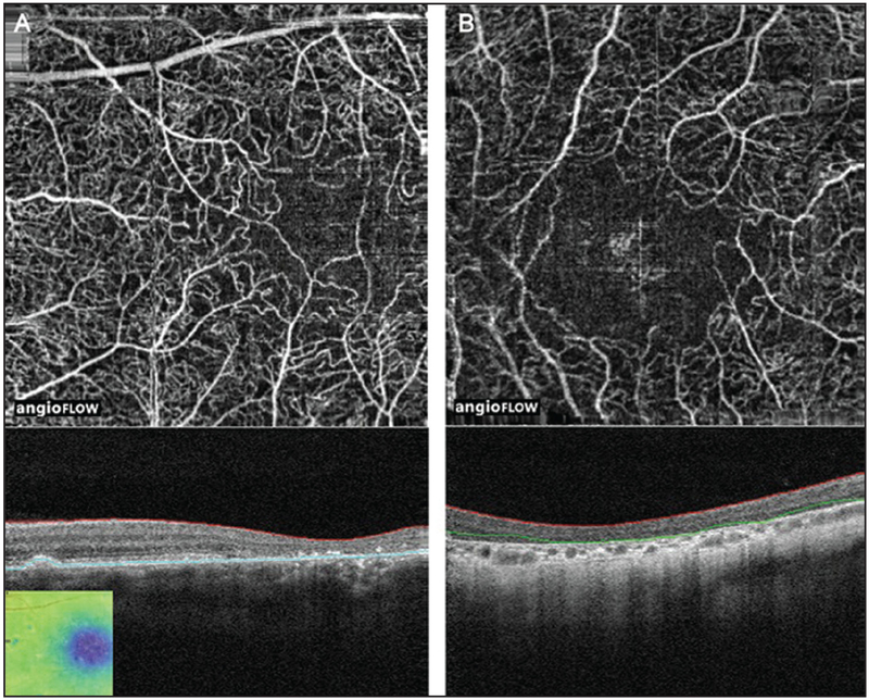 Figure 3: