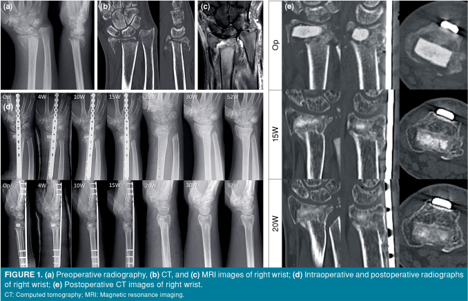 Figure 1
