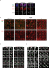 Figure 4—figure supplement 3.