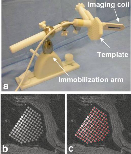 FIG. 1