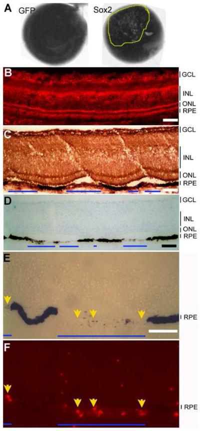 Fig.2