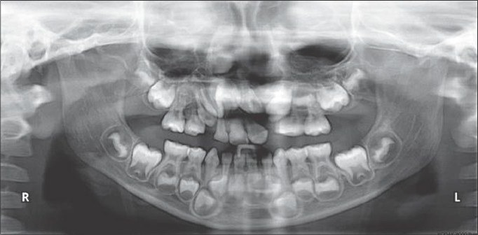 Figure 7b