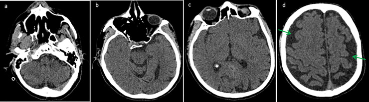 Fig 1