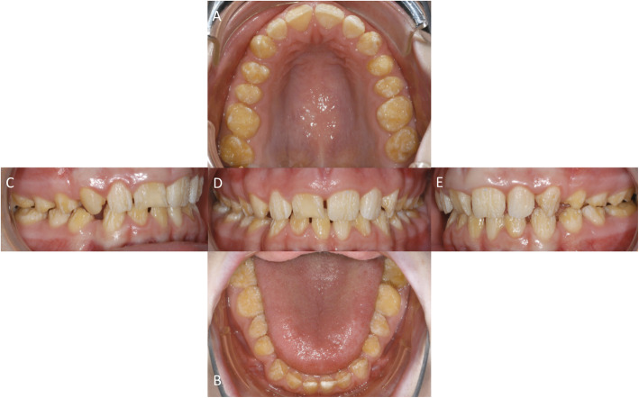 Fig. 2