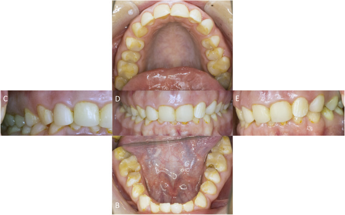 Fig. 6