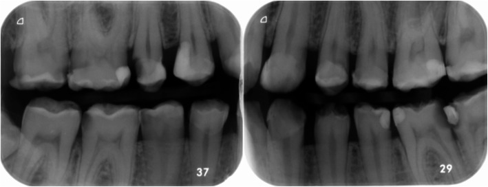 Fig. 5