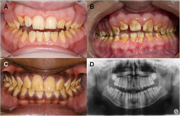 Fig. 1