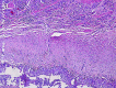 Fig. 2a.
