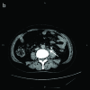 Fig. 1b.