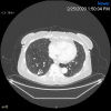 Fig. 2B