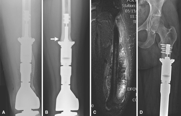 Fig. 1A–D