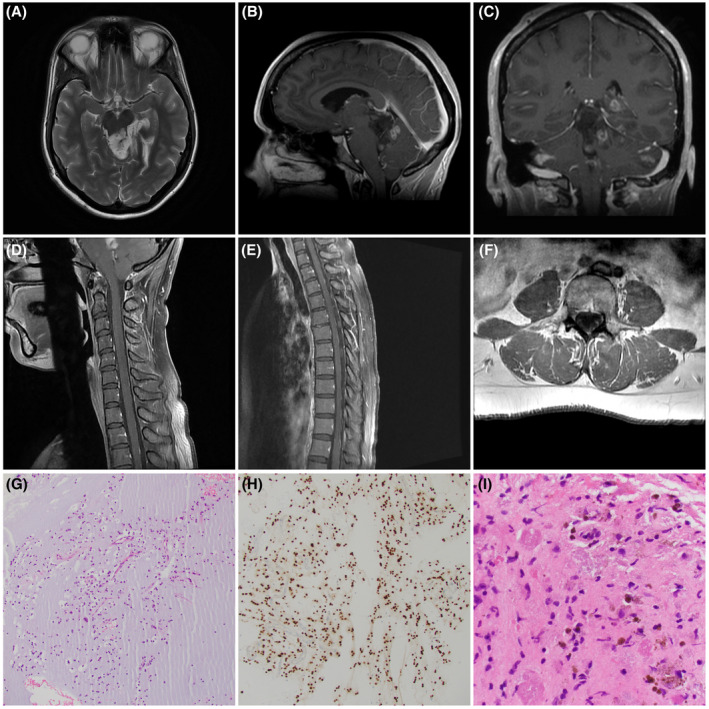 FIGURE 1