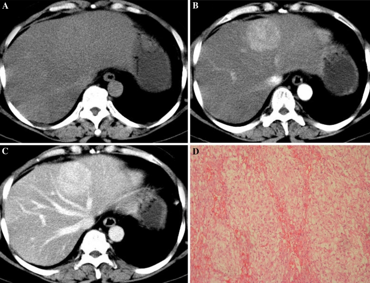 Fig. 3