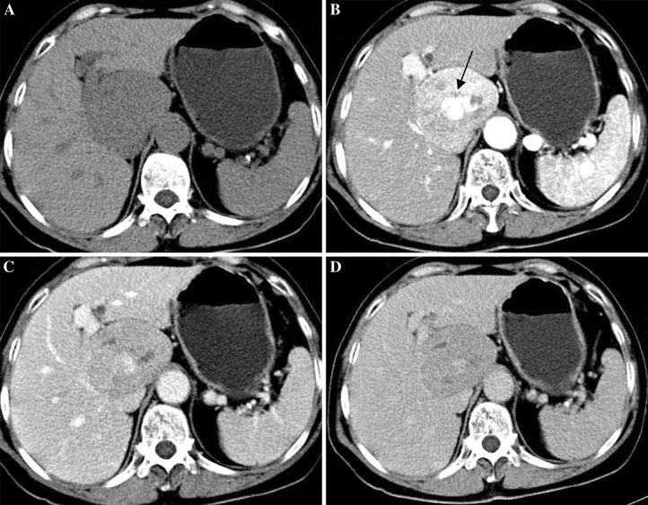 Fig. 1