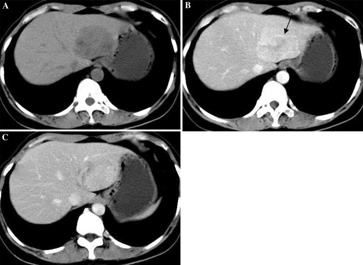 Fig. 2