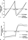 Fig. 2A–B