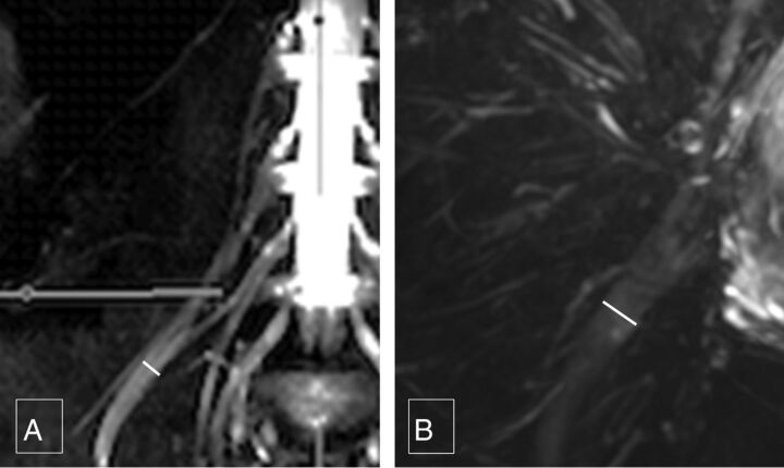 Fig 6.