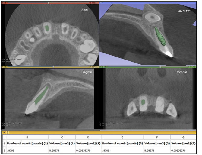 Figure 4