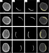 Fig. 12