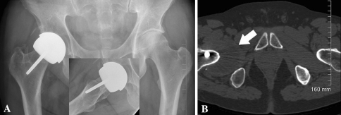 Fig. 3A–B