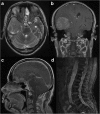 Fig. 6